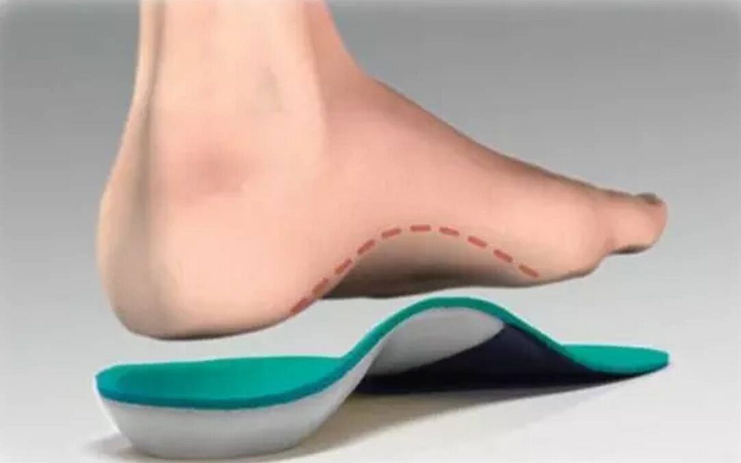 Ponuda ortopedskih uložaka uz prethodno obavljen pregled stopala